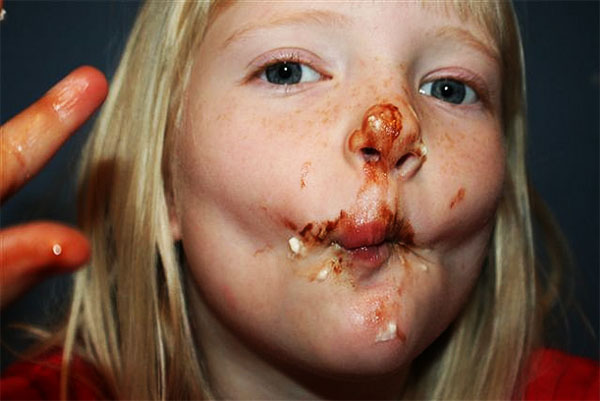 dieta-i-nadpobudliwosc